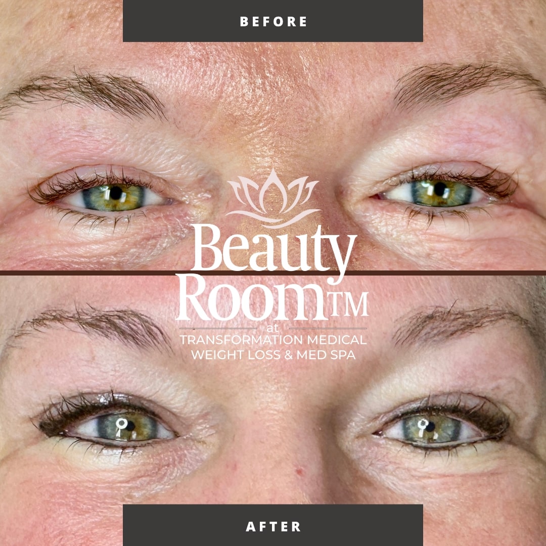 Before and After Image: Eyeliner - front