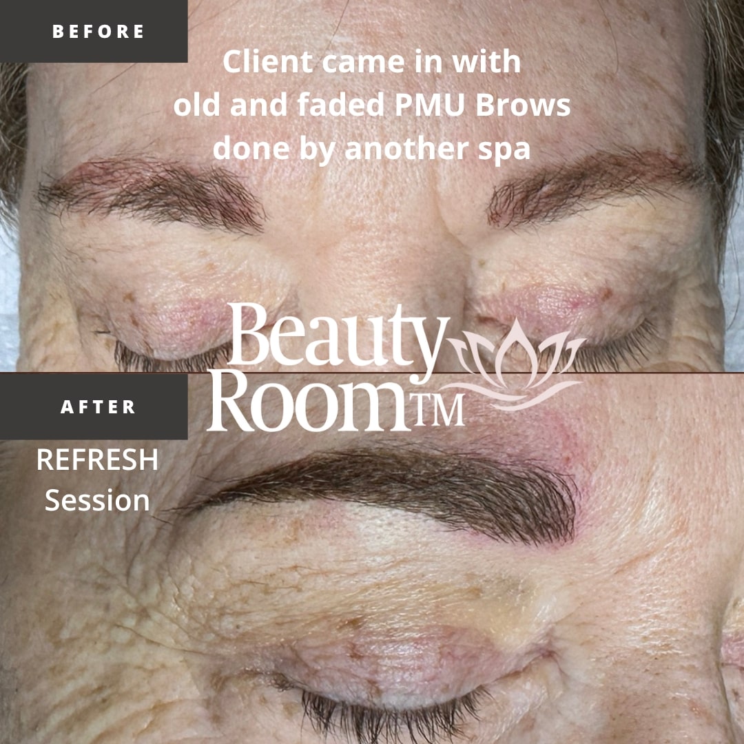 Before and After Image: NanoBrows - front