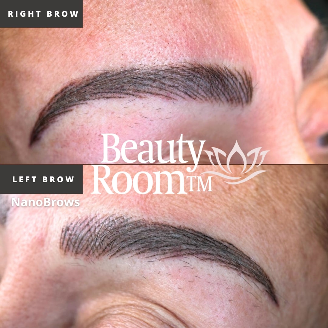 Before and After Image: NanoBrows - front