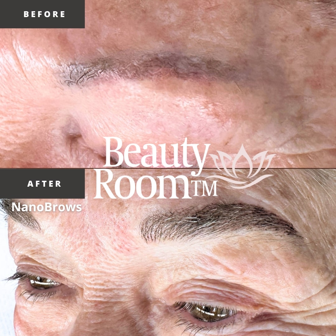 Before and After Image: NanoBrows - front