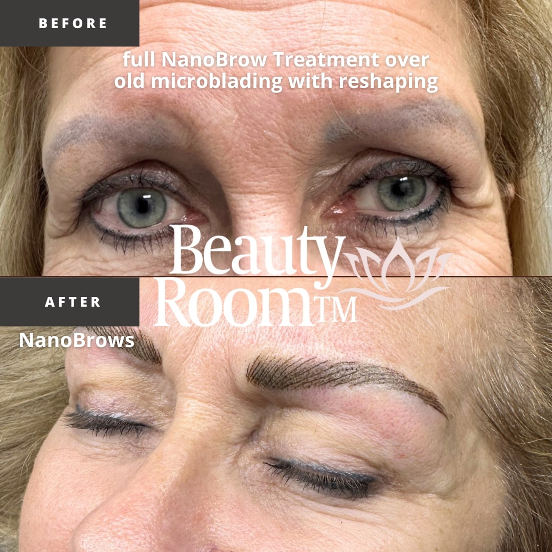 Before and After Image: NanoBrows - front