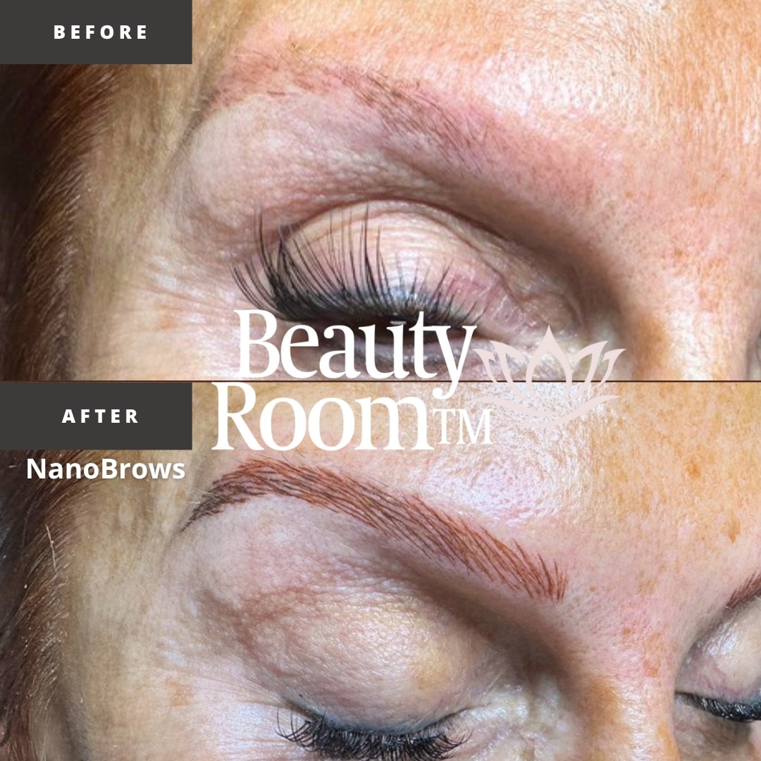 Before and After Image: NanoBrows - front