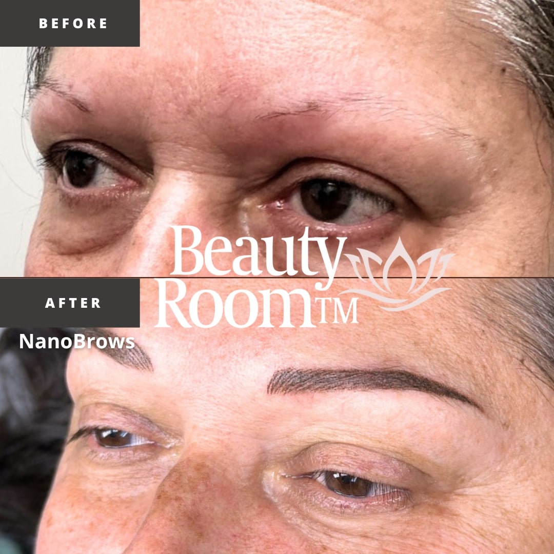 Before and After Image: NanoBrows - front