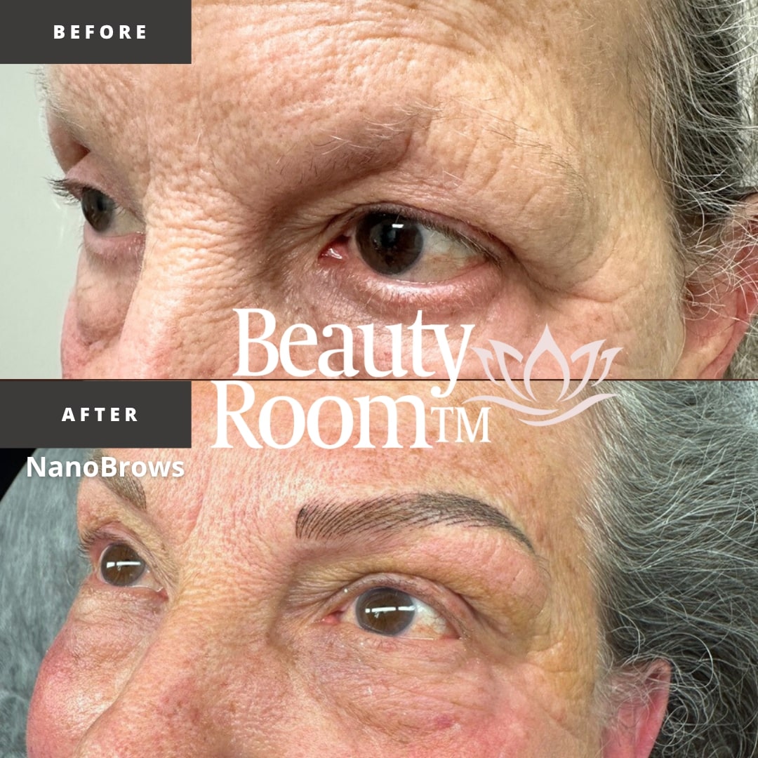 Before and After Image: NanoBrows - front