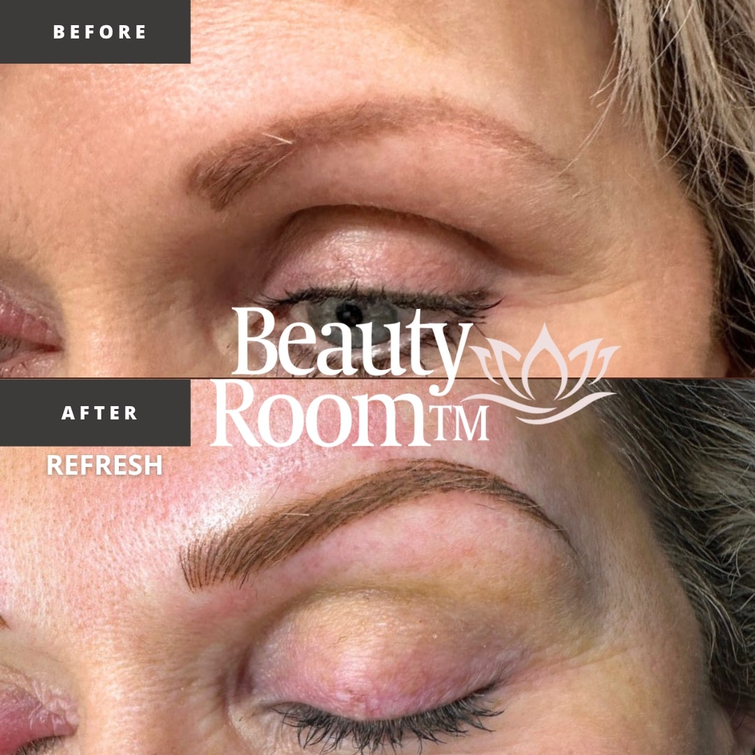 Before and After Image: NanoBrows - front