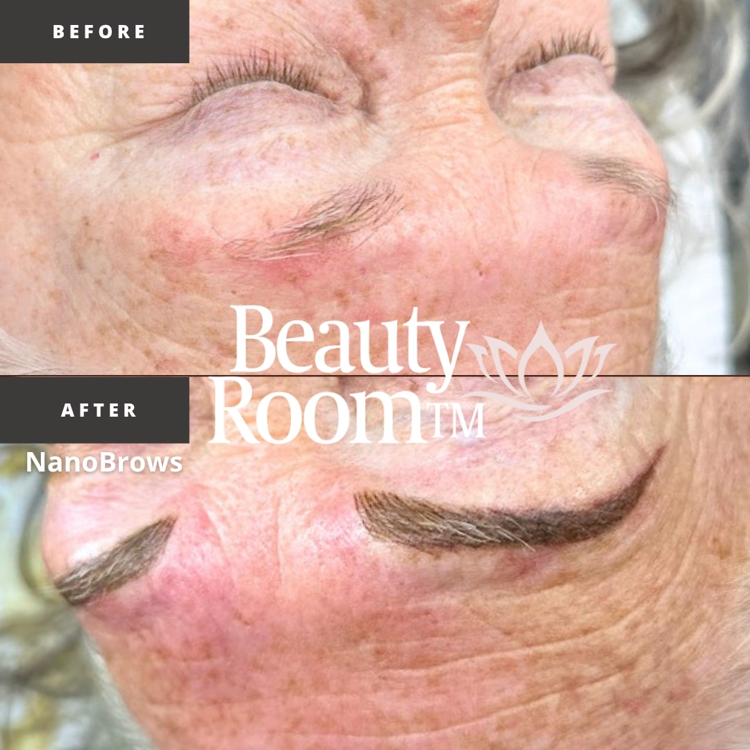 Before and After Image: NanoBrows - front