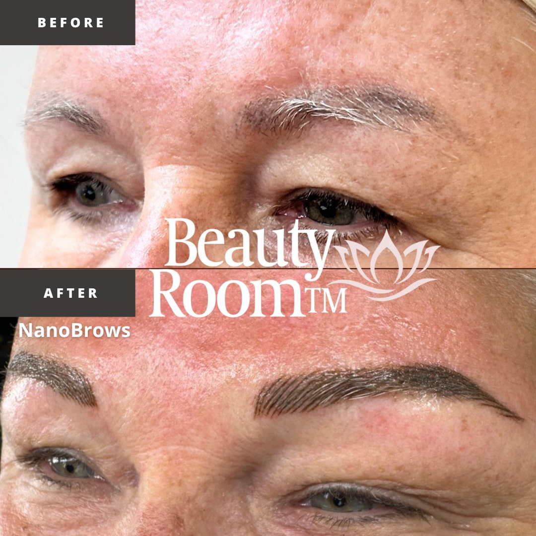 Before and After Image: NanoBrows - front