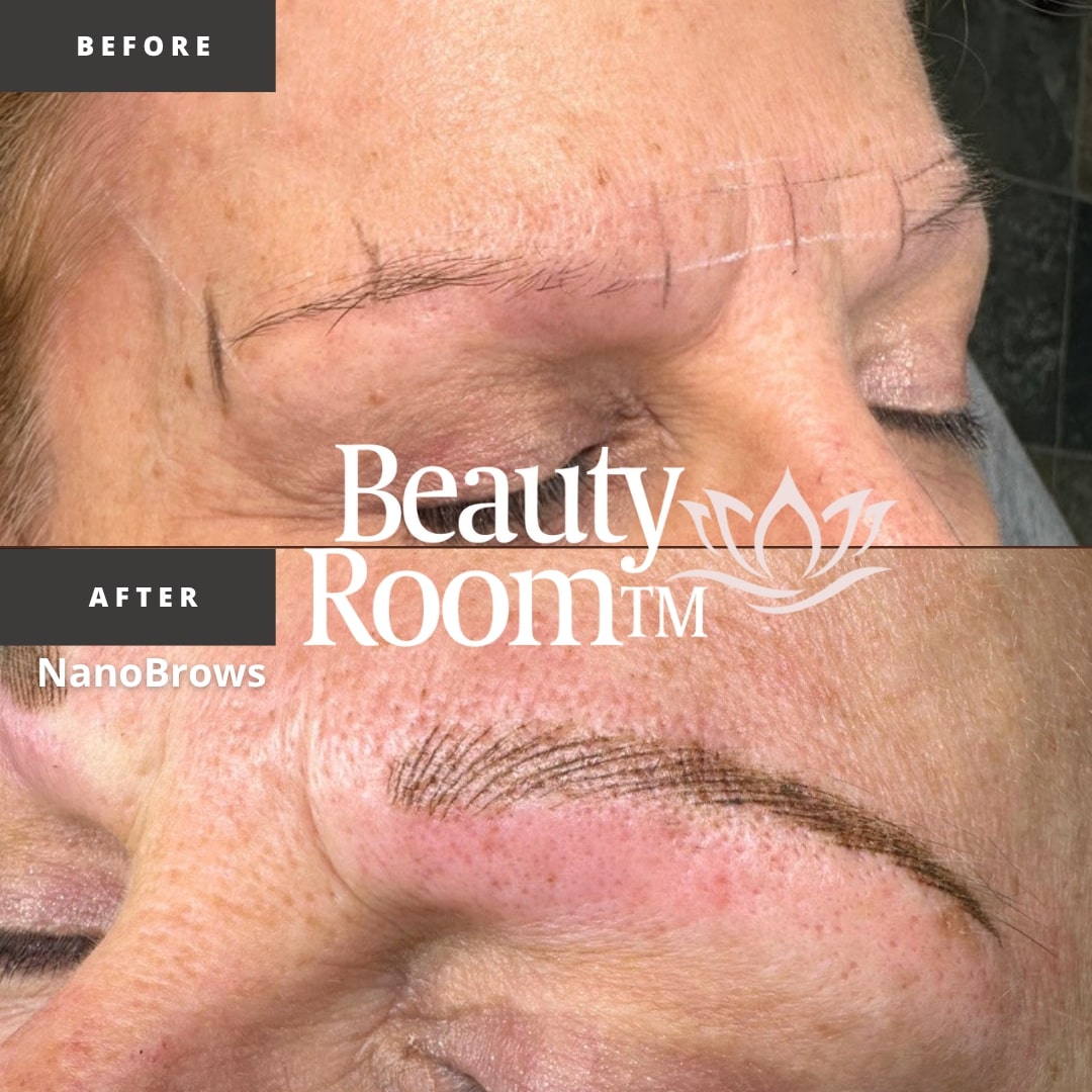 Before and After Image: NanoBrows - front