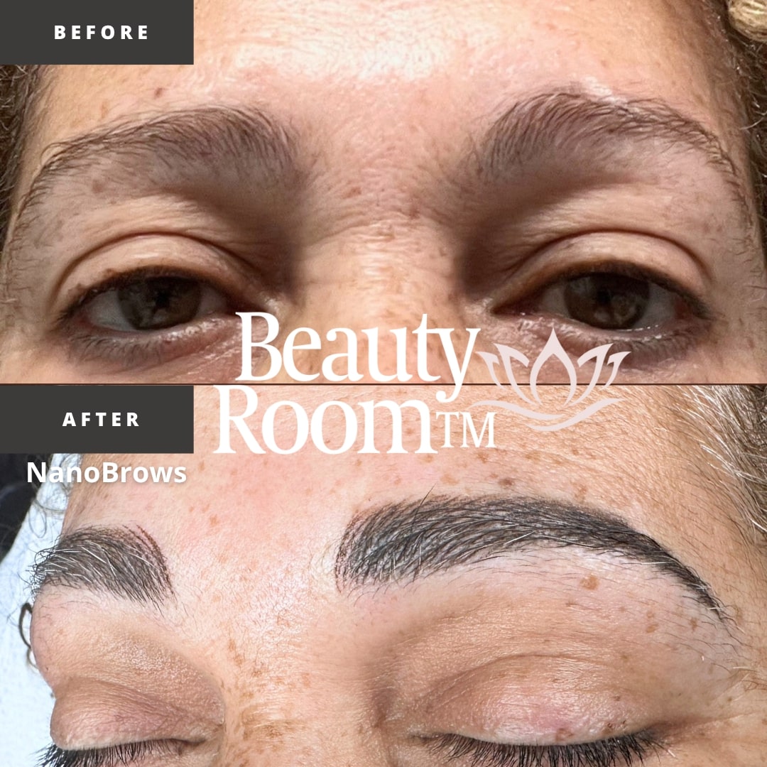 Before and After Image: NanoBrows - front