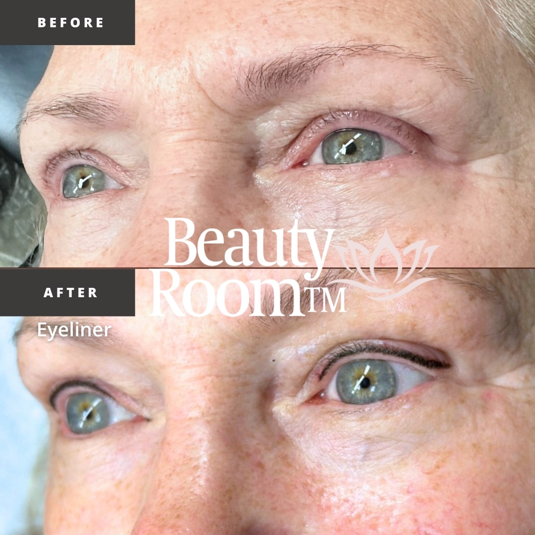 Before and After Image: Eyeliner - front