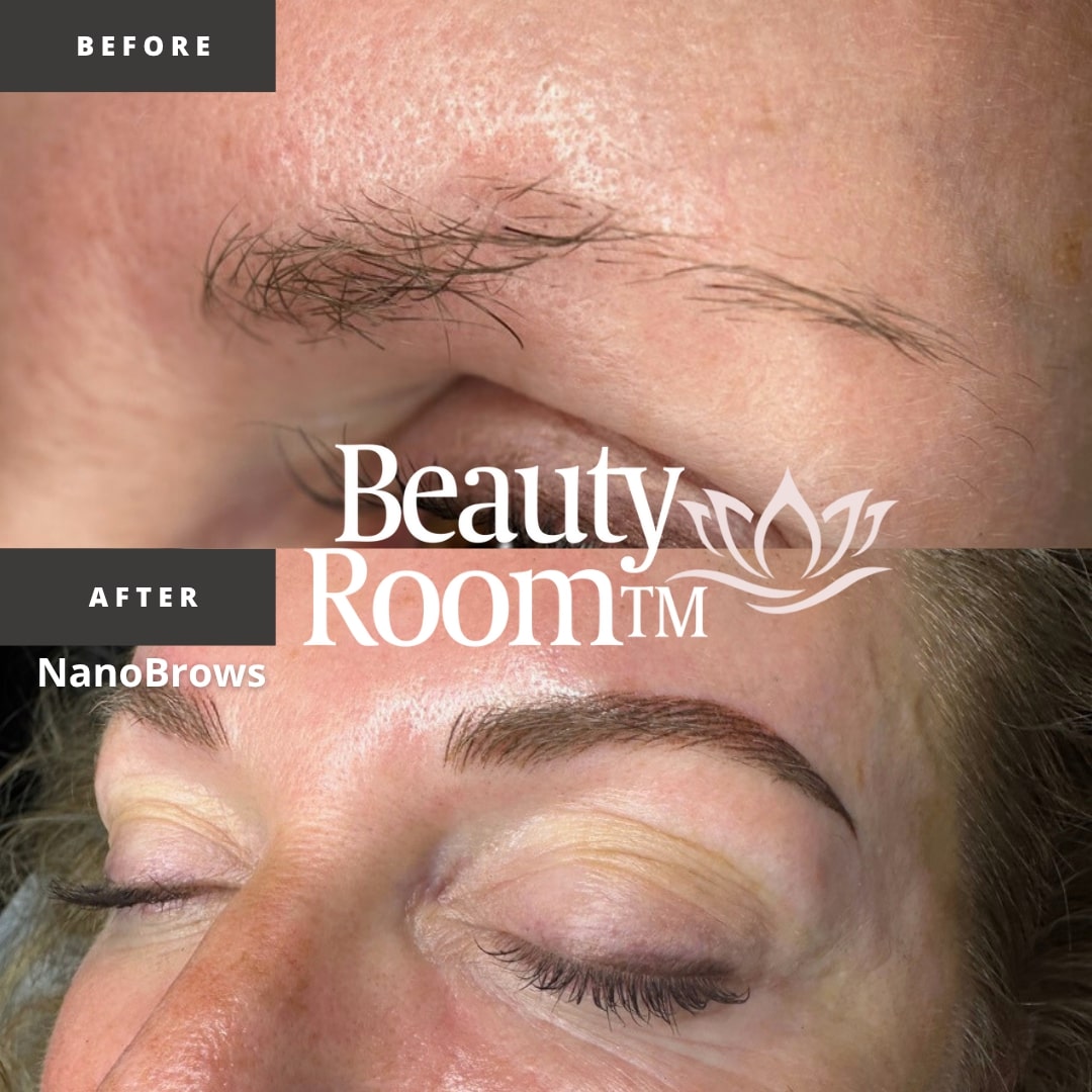 Before and After Image: NanoBrows - front