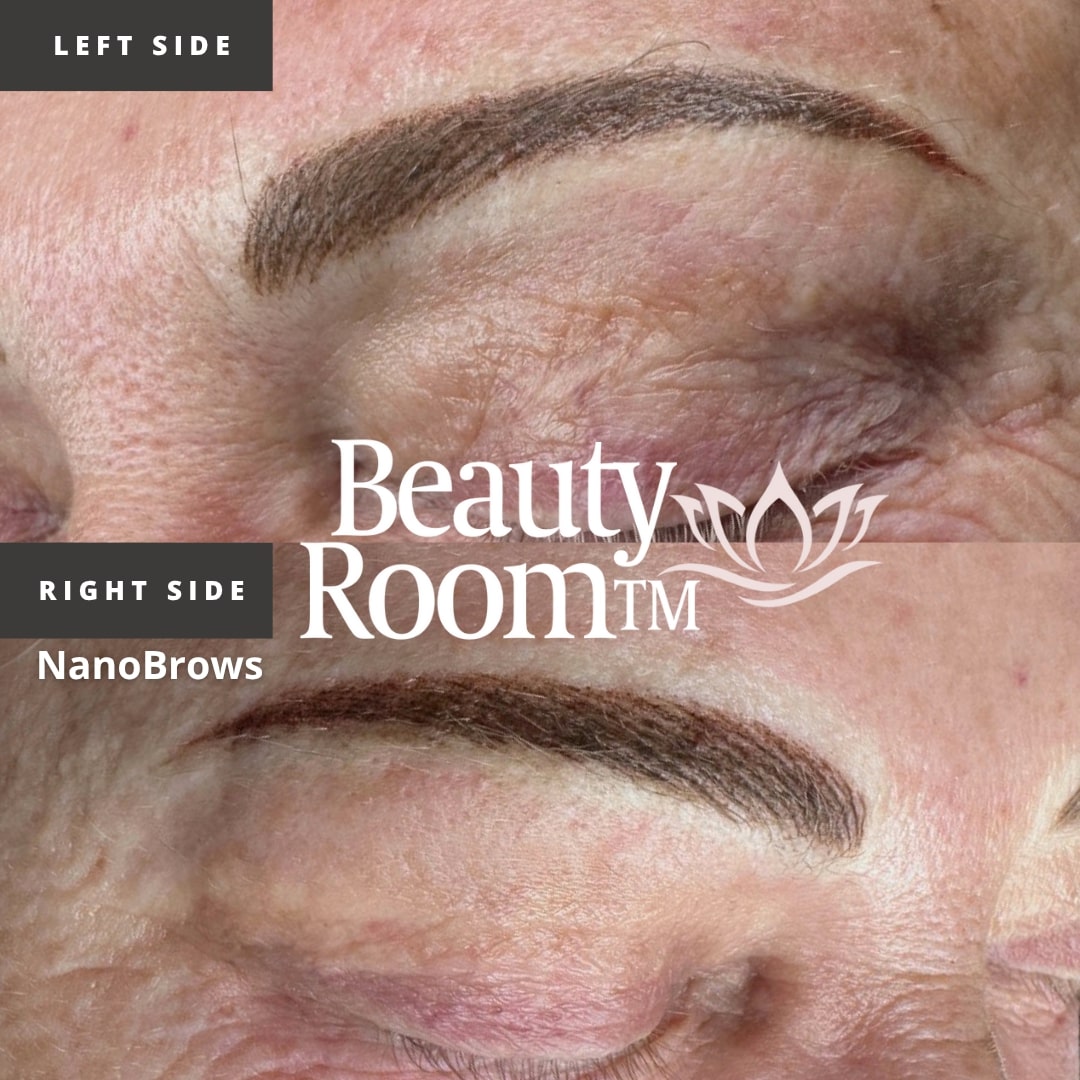 Before and After Image: NanoBrows - front