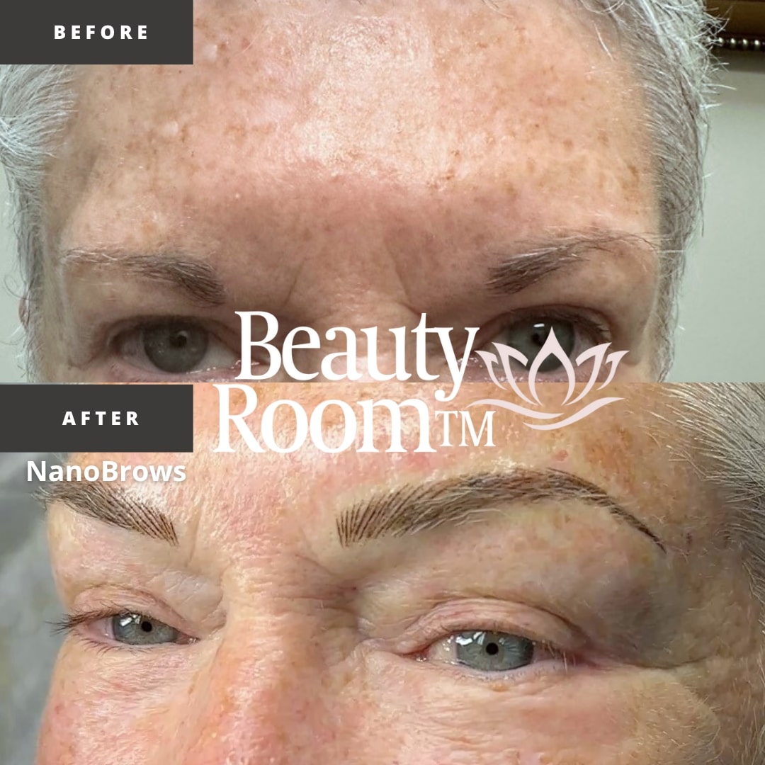Before and After Image: NanoBrows - front
