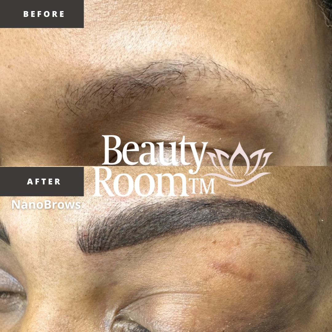 Before and After Image: NanoBrows - front