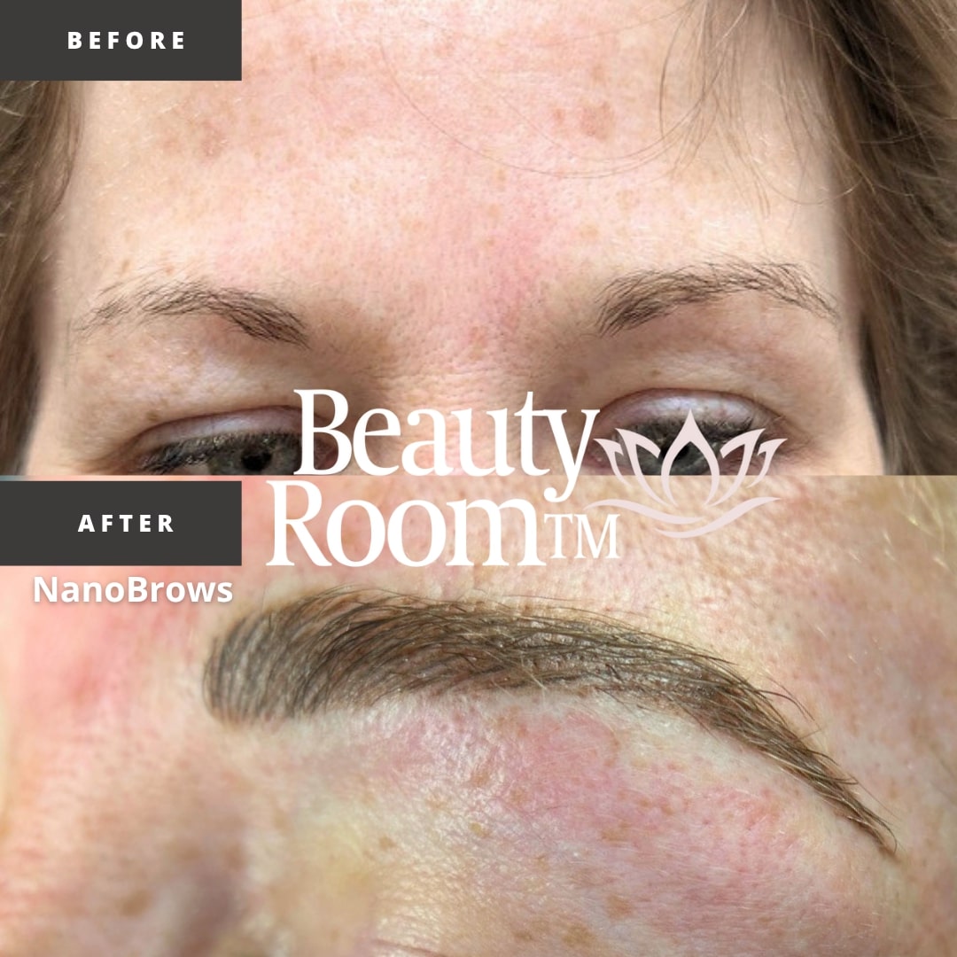 Before and After Image: NanoBrows - front