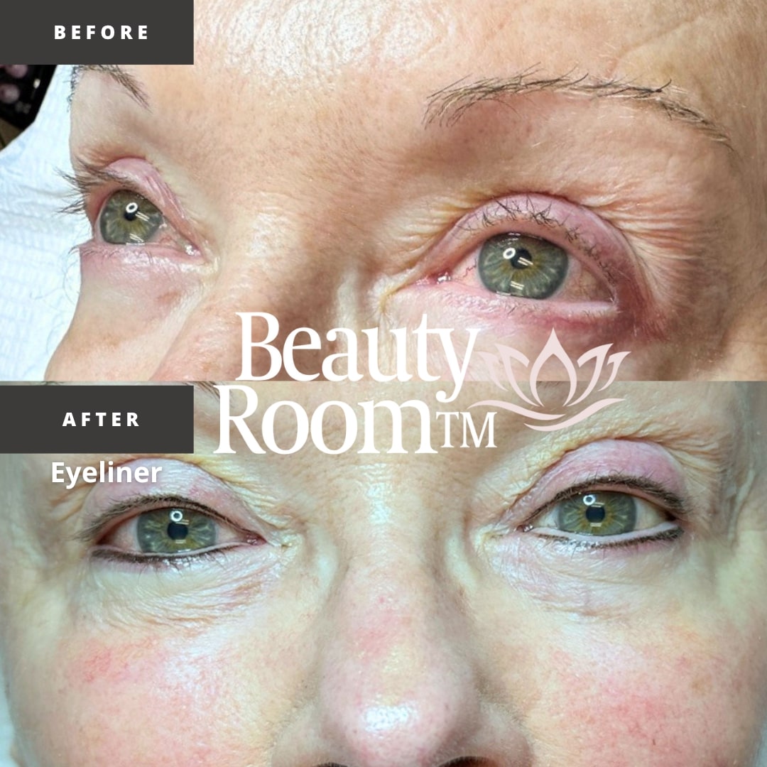 Before and After Image: Eyeliner - front