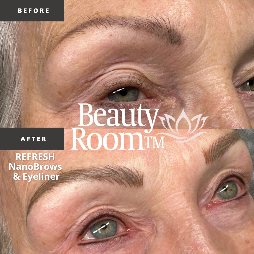 Before and After Image: NanoBrows & Eyeliner - right-side