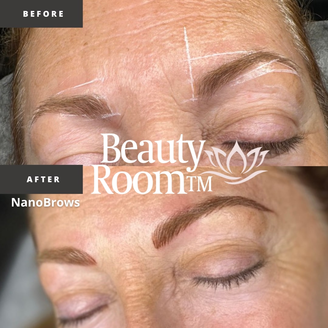 Before and After Image: NanoBrows - front