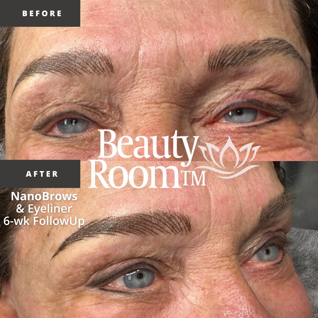Before and After Image: NanoBrows & Eyeliner - right-side