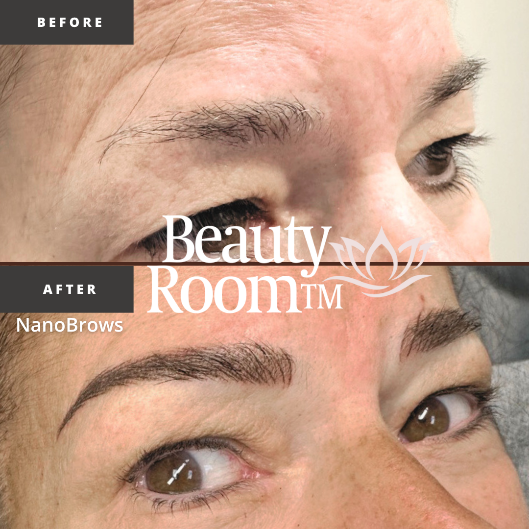Before and After Image: NanoBrows - front