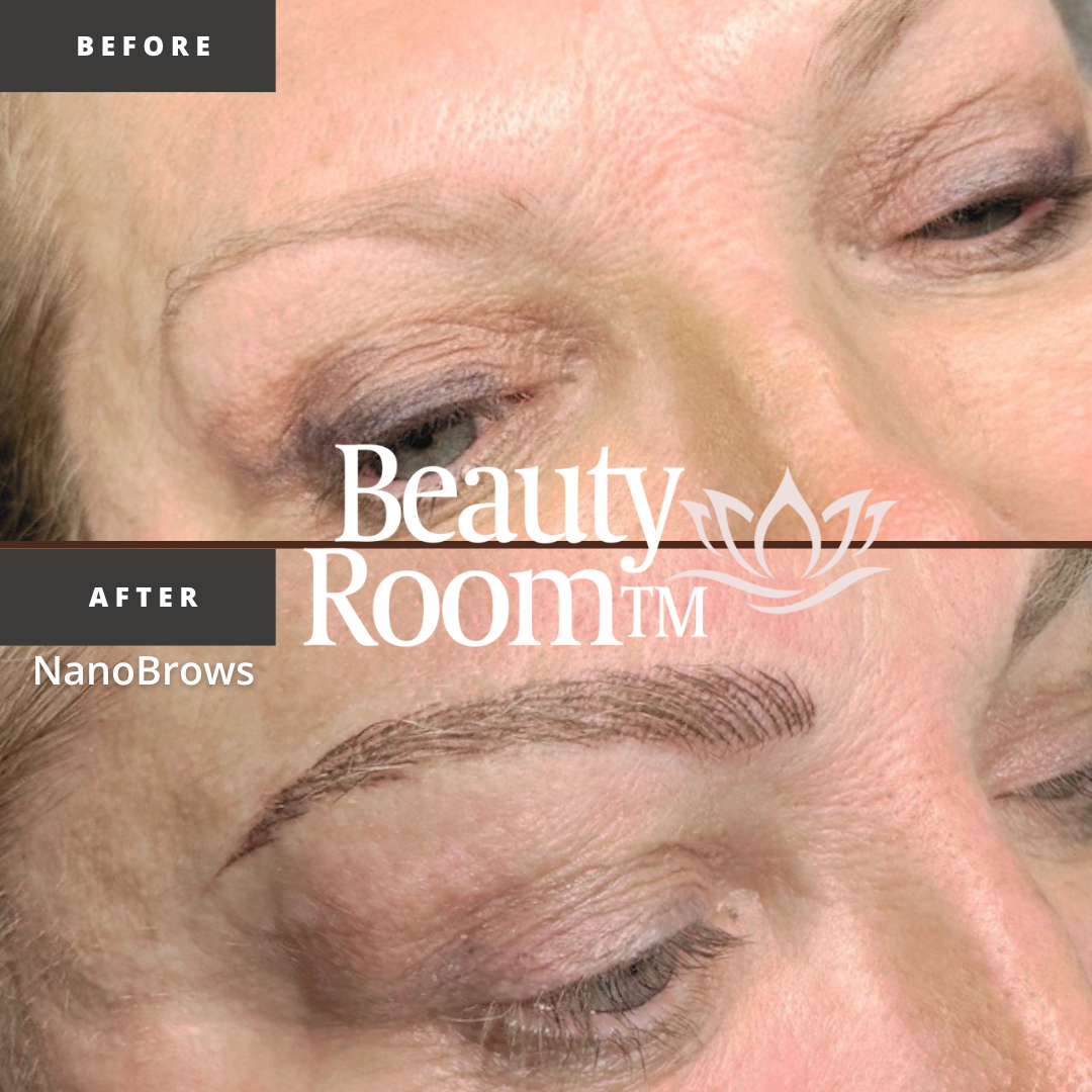 Before and After Image: NanoBrows - front